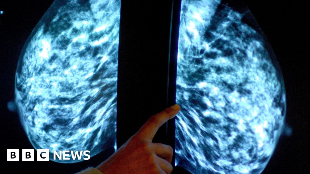 Survey asks for views on screening and v